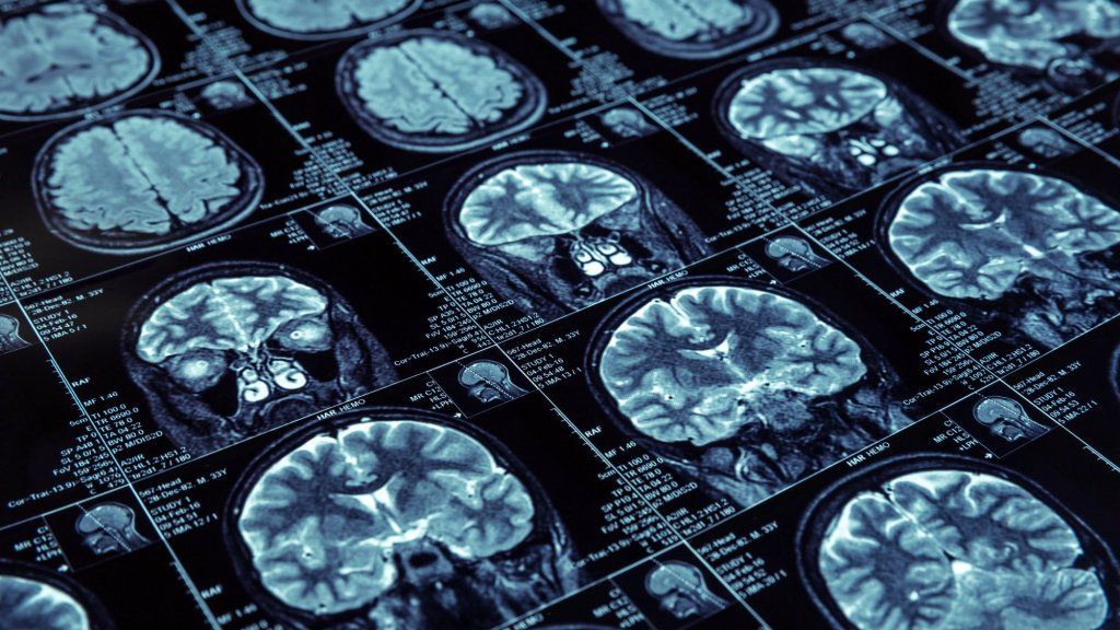 Left-Brained vs. Věda o pravém mozku je úplný mýtus, říká věda
